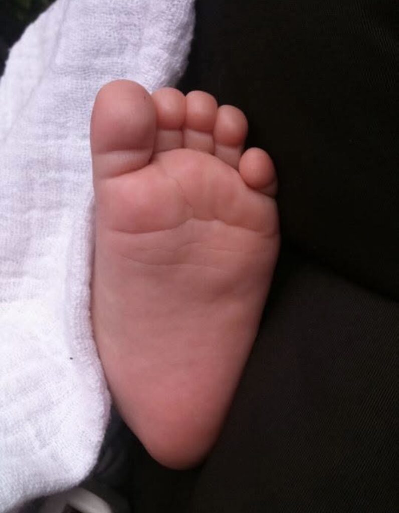 Pied de Liam